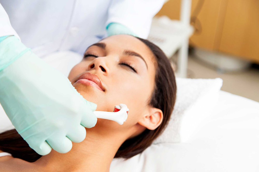 microneedling treatment