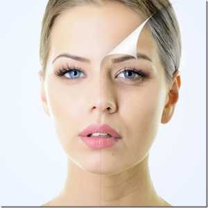 Dermal fillers injections