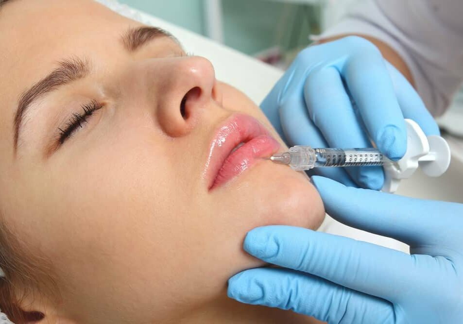 Crawley Botox Lip Filler where woman is undergoing her filler treatment